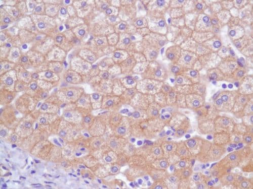 Egfr Antibody Sp84 Bsa And Azide Free Ab238803  Immunohistochemistry Formalin Pfa Fixed Paraffin Embedded Sections Img125725