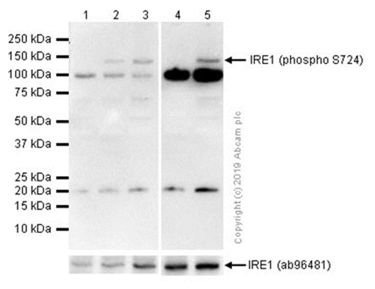 Anti-IRE1 (phospho S724) antibody [EPR5253](AB124945)