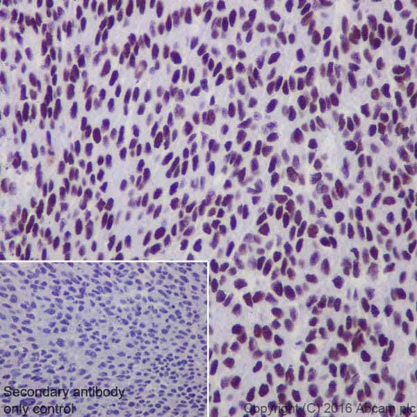 Anti-DBC-1 antibody [EPR19747] - BSA and Azide free(AB223530)