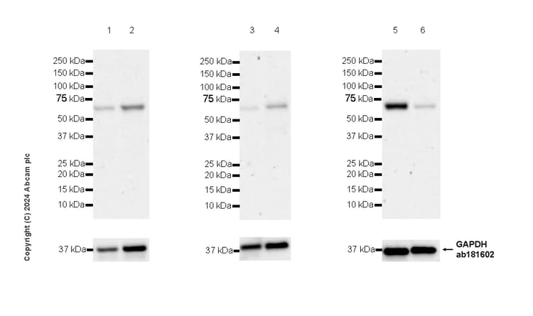 Rbpjk Antibody Rm2045 Ab317048  Western Blot Img432336