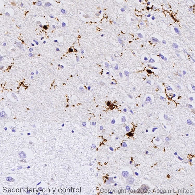Anti-Iba1 antibody [EPR16589](AB178847)