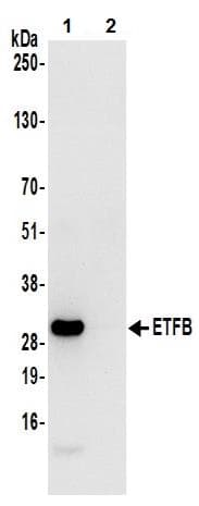 Anti-ETFB antibody(AB240593)