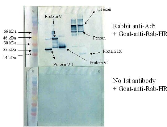 Anti-Adenovirus Type 5 antibody(ab6982)