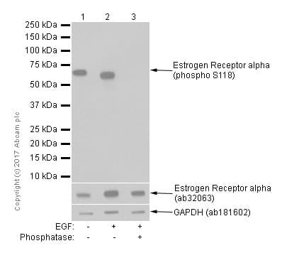 Estrogen Receptor Alpha Phospho S118 Antibody E91 Ab32396  Western Blot Img21405