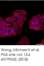 Phalloidin-iFluor 555 Reagent(AB176756)
