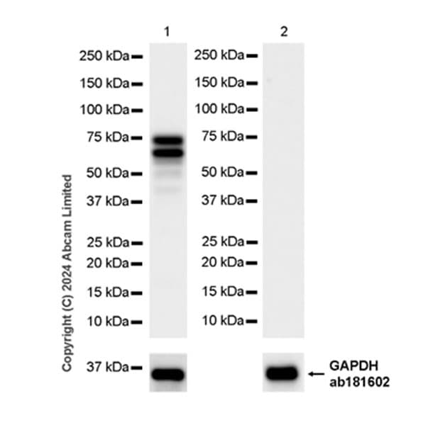 Anti-TOX antibody [EPR28108-10](ab322259)
