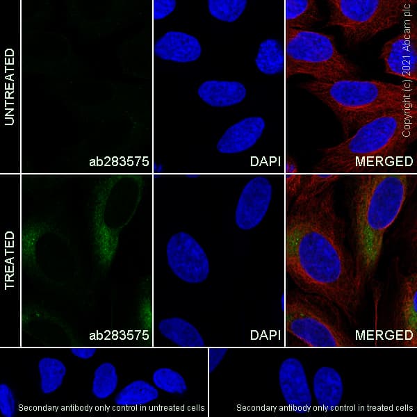 Anti-MMP9 antibody [RM1020](AB283575)