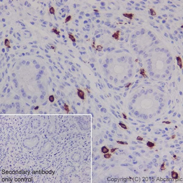 Anti-Iba1 antibody [EPR16589](AB178847)