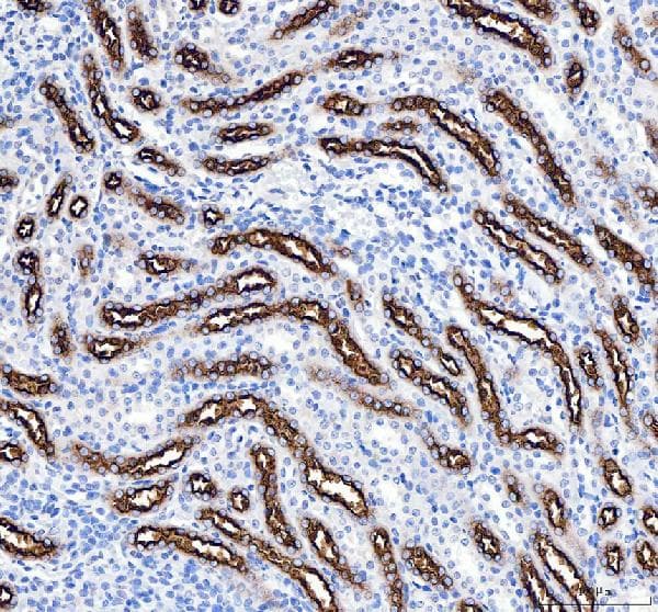 Slc12a1 Nkcc2 Antibody N Terminal Ab191315  Immunohistochemistry Formalin Pfa Fixed Paraffin Embedded Sections Img450988