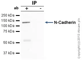 Anti-N Cadherin antibody - Intercellular Junction Marker(AB18203)