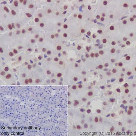 Gatad2a Antibody Epr18252 Ab188472  Immunohistochemistry Formalin Pfa Fixed Paraffin Embedded Sections Img132775
