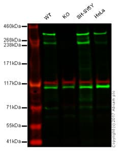 Anti-Huntingtin antibody [EP867Y](AB45169)