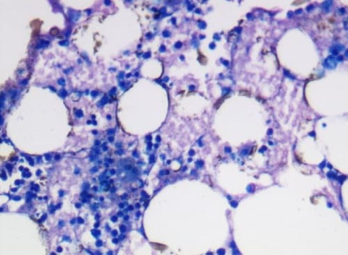 Giemsa Stain Kit Ab150670  Histology Img85093