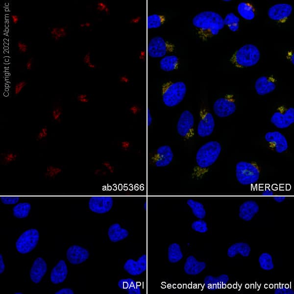 Alexa Fluor® 555 Anti-BDNF antibody [EPR1292](AB305366)