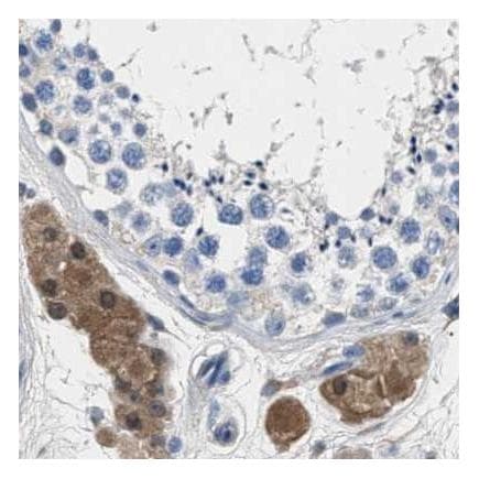 Anti-GST3 / GST pi antibody(AB259373)