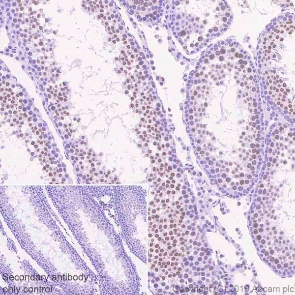 Anti-BRD1/BRL antibody [EPR12960](AB181060)