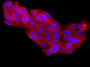 Txnrd1 Antibody Epr10205 Ab167411  Immunocytochemistry Immunofluorescence Img101429