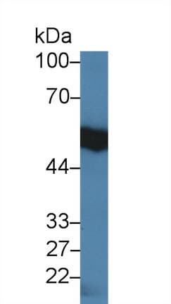 Anti-IL-18R1 antibody(ab231565)