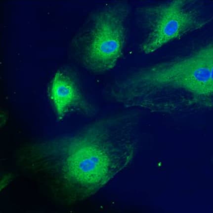 Anti-Calreticulin antibody - ER Marker(AB2907)