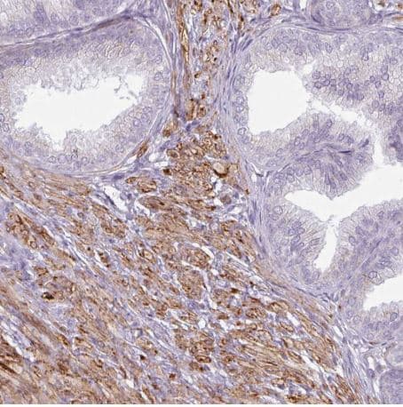 Map7d2 Antibody Ab151140  Immunohistochemistry Formalin Pfa Fixed Paraffin Embedded Sections Img38879