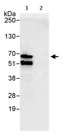 Atf2 Antibody Ab245407  Immunoprecipitation Img69800