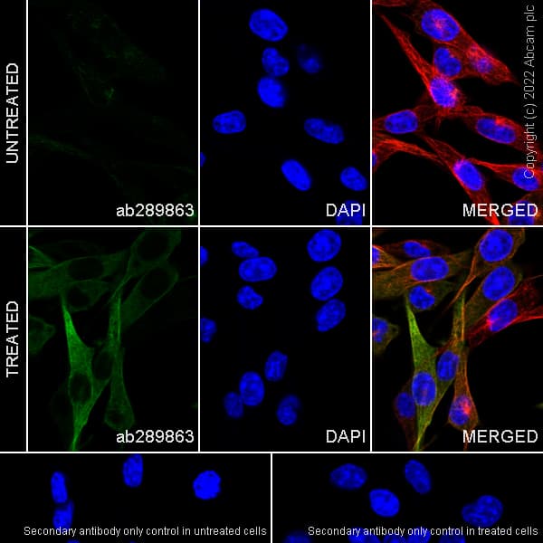 Anti-alpha Tubulin acetyl K40 antibody [EPR16772] - Rat IgG2a (Chimeric)(AB289863)