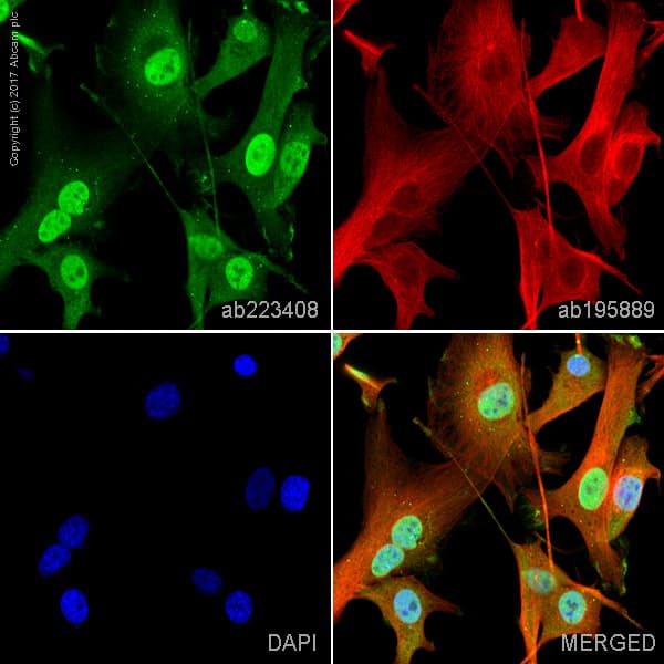 Alexa Fluor 488 Dlx5 Antibody Epr4488 Ab223408  Immunocytochemistry Immunofluorescence Img120717