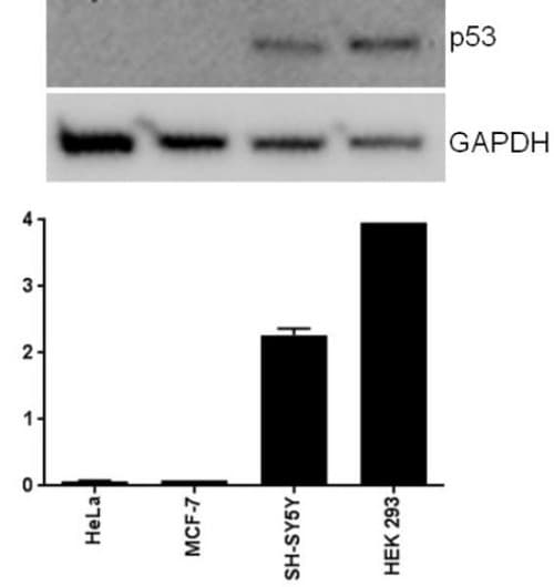 Human p53 ELISA Kit(AB171571)