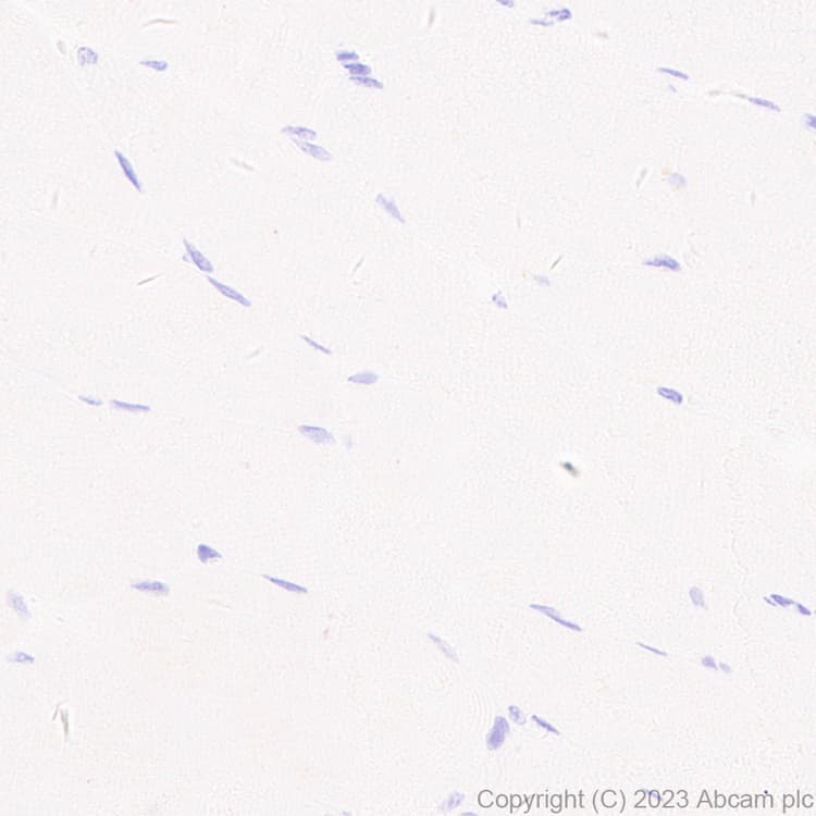 Pan Cytokeratin Antibody Epr28285 45 Bsa And Azide Free Ab308263  Immunohistochemistry Formalin Pfa Fixed Paraffin Embedded Sections Img408897