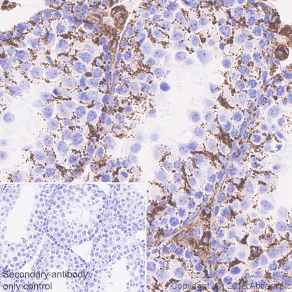 Abat Gaba T Antibody Epr20842 Bsa And Azide Free Ab233702  Immunohistochemistry Formalin Pfa Fixed Paraffin Embedded Sections Img15498