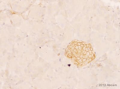 Anti-N Cadherin antibody [EPR1791-4](AB76011)