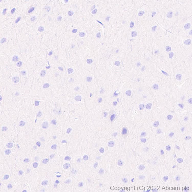 Anti-TNF alpha antibody [RM1005](AB307164)