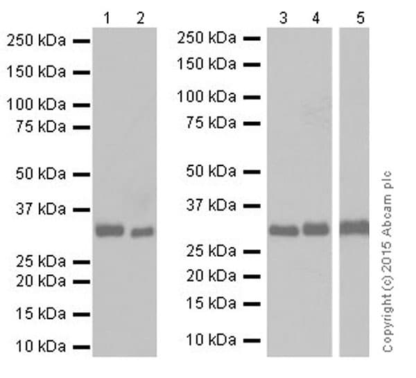 Anti-CNOT7 antibody [EPR18722](AB195587)