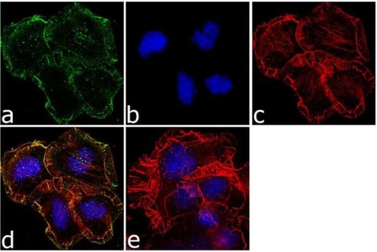 Mu Opioid Receptor Antibody Ab17934  Immunocytochemistry Img166685