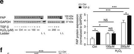 Anti-Fibroblast activation protein, alpha antibody(AB53066)