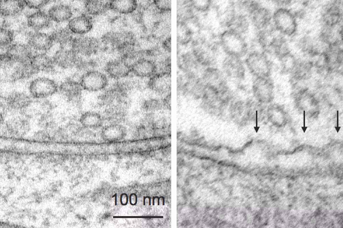 Hippocampal Neurons Kid21764975
