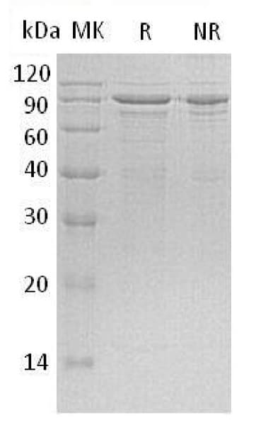 Recombinant Human MeCP2 protein (His tag)(AB196070)