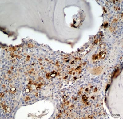 Anti-CD68 antibody [KP1](ab955)