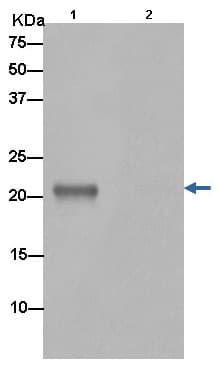 Anti-Bok antibody [EPR15331](AB186745)