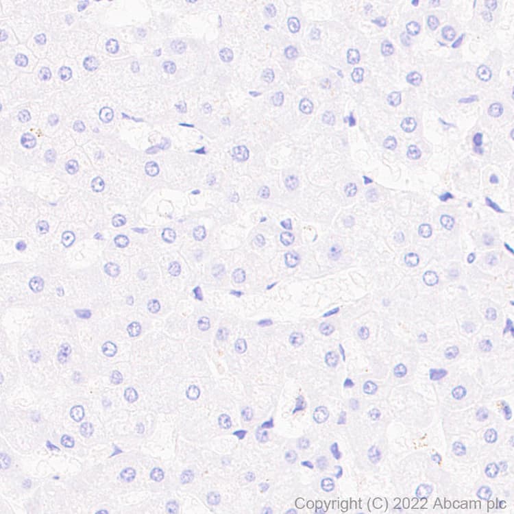 Anti-P2Y12 antibody [EPR26298-93](AB300140)