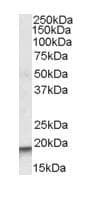 Arpc4 Antibody Ab80502  Western Blot Img14404