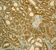 Calpain 1 Antibody Epr3319 Ab108400  Immunohistochemistry Formalin Pfa Fixed Paraffin Embedded Sections Img138645