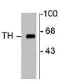 Anti-Tyrosine Hydroxylase antibody - Neuronal Marker(AB112)