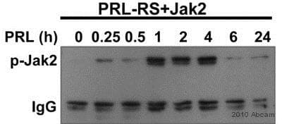 Anti-JAK2 (phospho Y1007 + Y1008) antibody [E132](AB32101)