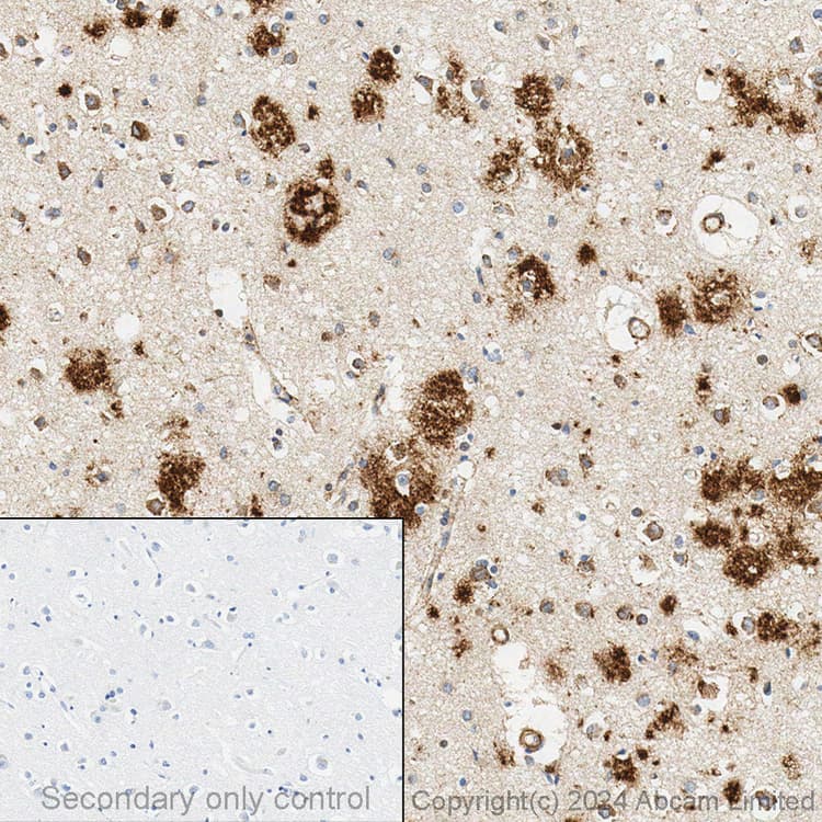 Anti-beta Amyloid 1-42 antibody [mOC64](AB201060)