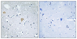 Cit Antibody Ab110897  Immunohistochemistry Formalin Pfa Fixed Paraffin Embedded Sections Img17841