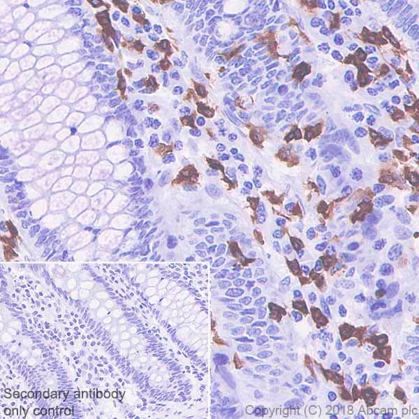 15 Lipoxygenase 1 Antibody Epr22136 Bsa And Azide Free Ab243555  Immunohistochemistry Formalin Pfa Fixed Paraffin Embedded Sections Img45971