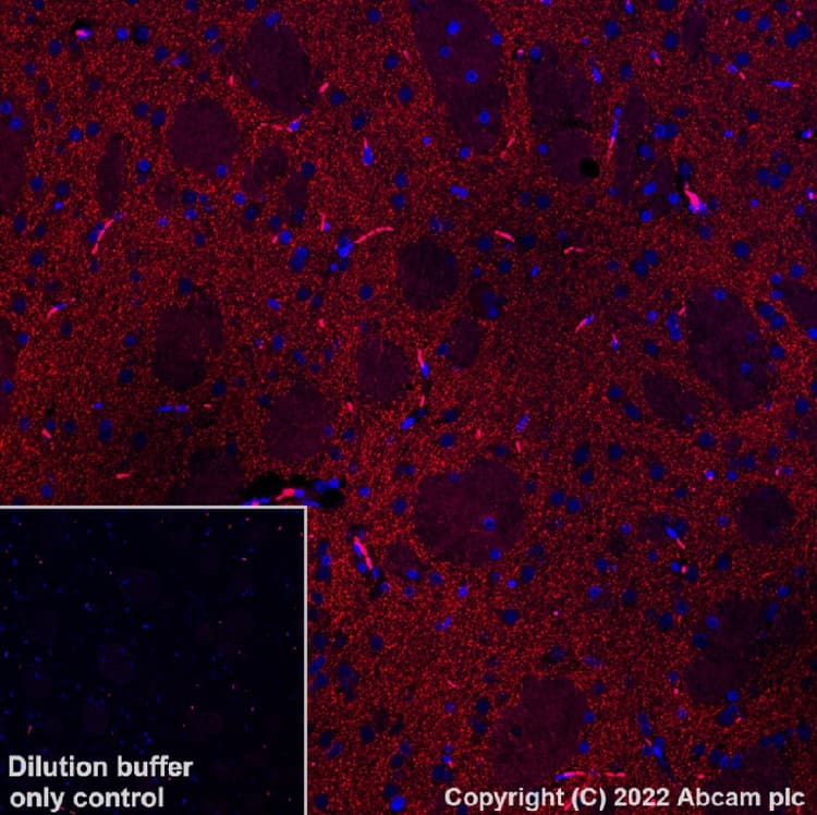 Alexa Fluor 568 Dopamine Transporter Antibody Epr19695 Ab303466  Immunohistochemistry Formalin Pfa Fixed Paraffin Embedded Sections Img402080