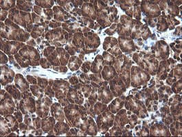 Anti-Von Hippel Lindau/VHL antibody [OTI1E1] - BSA and Azide free(AB273655)