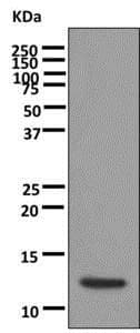 Anti-alpha Lactalbumin antibody [EPR12460](AB178431)